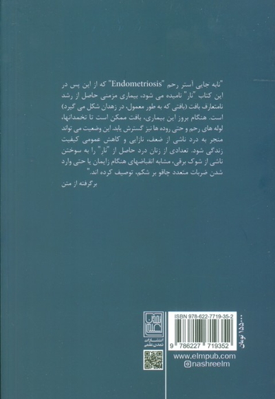نابجایی آستر رحم - زاهدان